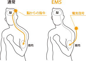 図：EMSとは
