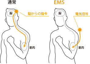 図:EMSとは